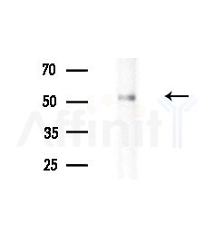 UGT1A4 Antibody - Western blot analysis of lysates from Rat liver, using UGT1A4 Antibody at 1/1000 dilution.