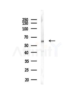 UGT1A4 Antibody - Western blot analysis of lysates from Rat liver, using UGT1A4 Antibody at 1/1000 dilution.