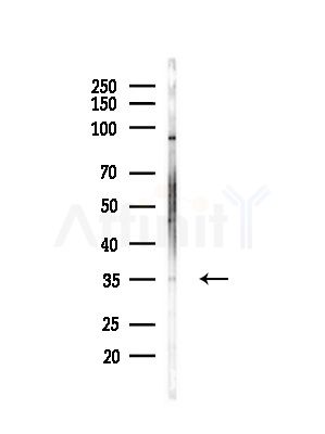 HAX1 Antibody - Western blot analysis of lysates from HepG2 cells(LPS,4h treatment), using HAX1 Antibody at 1/1000 dilution.