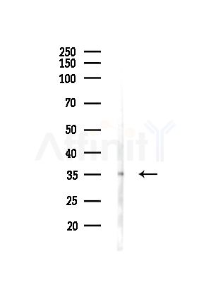 RPLP0 Antibody - Western blot analysis of lysates from Hela cells, using RPLP0 Antibody at 1/1000 dilution.