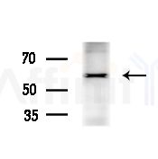 ATIC Antibody - Western blot analysis of lysates from various samples, using ATIC Antibody at 1/1000 dilution.