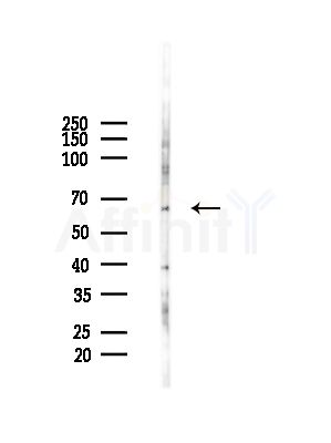 ATIC Antibody - Western blot analysis of lysates from HepG2 cells(LPS,4h treatment), using ATIC Antibody at 1/1000 dilution.