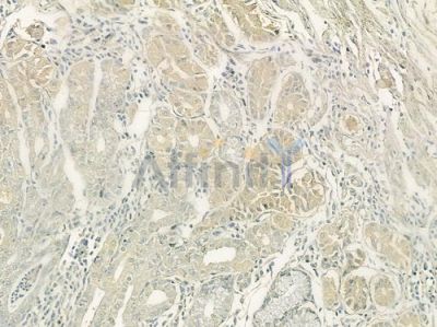Plastin L Antibody - DF7401 at 1/100 staining human normal gastric tissue by IHC-P.