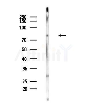 SH2B1 Antibody - Western blot analysis of lysates from B16F10-LUC cells(UV,30min treatment), using SH2B1 Antibody at 1/1000 dilution.