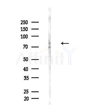 SH2B1 Antibody - Western blot analysis of lysates from MCF7 cells(heat-shock,45min treatment), using SH2B1 Antibody at 1/1000 dilution.