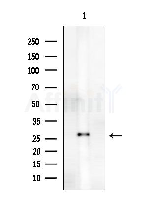 CRYBB2 Antibody - Western blot analysis of extracts from EC304 cells, using CRYBB2 Antibody at 1/1000 dilution.