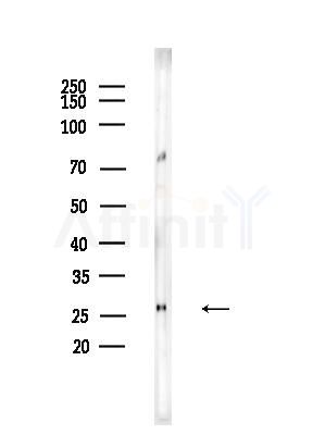 CRYBB2 Antibody - Western blot analysis of lysates from EC304 cells, using CRYBB2 Antibody at 1/1000 dilution.