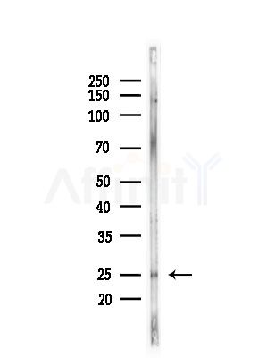 Rabl2 Antibody - Western blot analysis of lysates from LoVo cells(heat-shock,45min treatment), using Rabl2 Antibody at 1/1000 dilution.