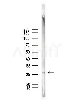 Rabl2 Antibody - Western blot analysis of lysates from Mouse lung, using Rabl2 Antibody at 1/1000 dilution.