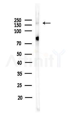 WHSC1L1 Antibody - Western blot analysis of lysates from HepG2 cells(heat-shock,45min treatment), using WHSC1L1 Antibody at 1/1000 dilution.