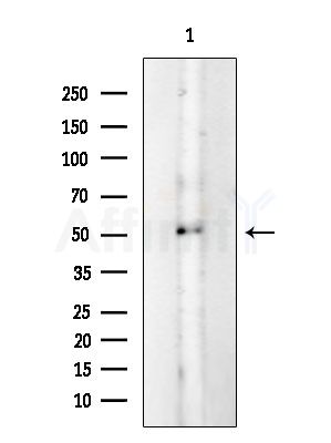 Hemopexin Antibody - Western blot analysis of extracts from EC304 cells, using Hemopexin Antibody at 1/1000 dilution.