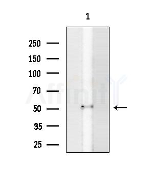 Hemopexin Antibody - Western blot analysis of extracts from HUVEC cells, using Hemopexin Antibody at 1/1000 dilution.