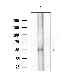 Hemopexin Antibody - Western blot analysis of extracts from Hela cells(starvation treatment), using Hemopexin Antibody at 1/1000 dilution.
