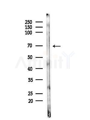 Hemopexin Antibody - Western blot analysis of lysates from Hela cells(starvation,24h treatment), using Hemopexin Antibody at 1/1000 dilution.