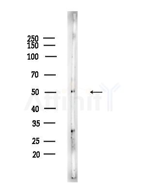 Hemopexin Antibody - Western blot analysis of lysates from EC304 cells, using Hemopexin Antibody at 1/1000 dilution.