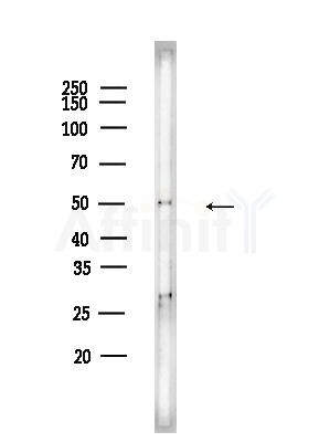 Hemopexin Antibody - Western blot analysis of lysates from HUVEC cells, using Hemopexin Antibody at 1/1000 dilution.