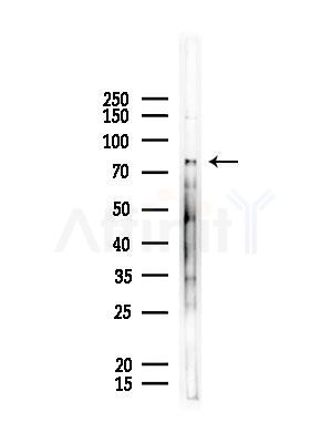 DCLRE1C Antibody - Western blot analysis of lysates from Rat lung, using DCLRE1C Antibody at 1/1000 dilution.