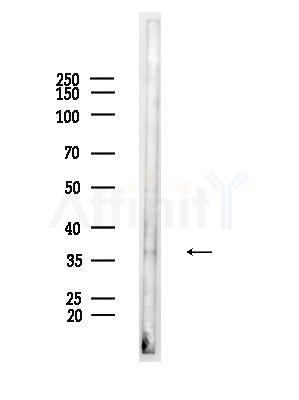 LSP1 Antibody - Western blot analysis of lysates from Mouse liver, using LSP1 Antibody at 1/1000 dilution.