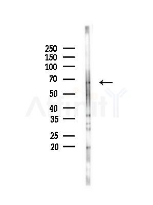 TPP1 Antibody - Western blot analysis of lysates from Mouse testis, using TPP1 Antibody at 1/1000 dilution.