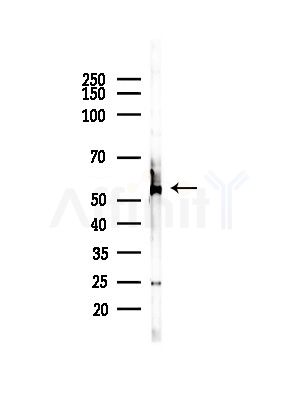 PLTP Antibody - Western blot analysis of lysates from COLO205 cells(heat-shock,45min treatment), using PLTP Antibody at 1/1000 dilution.