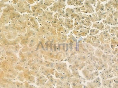 HEXA Antibody - DF7436 at 1/100 staining human normal liver tissue by IHC-P.
