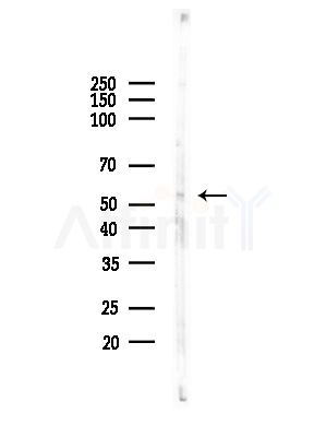 5HT3A receptor Antibody - Western blot analysis of lysates from 3T3-L1 P6(heat-shock,45min treatment), using 5HT3A receptor Antibody at 1/1000 dilution.