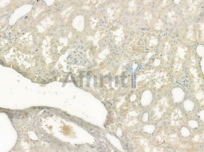 5HT3A receptor Antibody - DF7437 at 1/100 staining human normal kidney tissue by IHC-P.