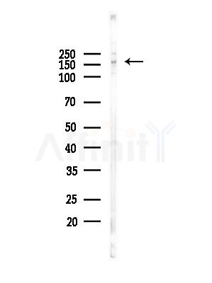ATP7B Antibody - Western blot analysis of lysates from 3T3-L1 P6(heat-shock,45min treatment), using ATP7B Antibody at 1/1000 dilution.