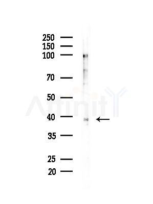 SH3GL2 Antibody - Western blot analysis of lysates from Rat brain, using SH3GL2 Antibody at 1/1000 dilution.