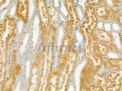 SH3GL2 Antibody - DF7467 at 1/100 staining human normal kidney tissue by IHC-P.