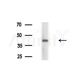 ADH6 Antibody - Western blot analysis of lysates from Hela cells(heat-shock,45min treatment), using ADH6 Antibody at 1/1000 dilution.
