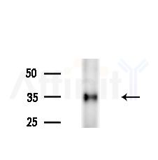 ADH6 Antibody - Western blot analysis of lysates from Mouse brain, using ADH6 Antibody at 1/1000 dilution.
