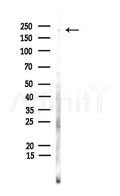 TRPM7 Antibody - Western blot analysis of lysates from Hela cells, using TRPM7 Antibody at 1/1000 dilution.