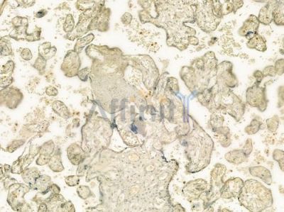 TRPM7 Antibody - DF7513 at 1/100 staining human normal placenta tissue by IHC-P.