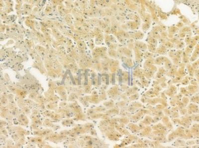 TRPM7 Antibody - DF7513 at 1/100 staining human normal liver tissue by IHC-P.
