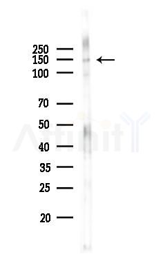 LATS2 Antibody - Western blot analysis of lysates from PC12 cells(LPS,4h treatment), using LATS2 Antibody at 1/1000 dilution.