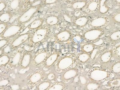 LATS1/2 Antibody - DF7517 at 1/100 staining human normal kidney tissue by IHC-P.