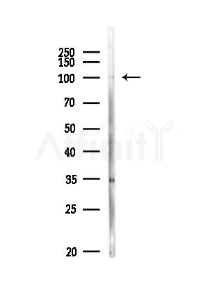 Rad21 Antibody - Western blot analysis of lysates from MDA-MB-231 cells(heat-shock,45min treatment), using Rad21 Antibody at 1/1000 dilution.
