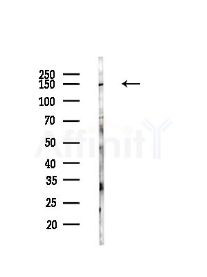 Claspin Antibody - Western blot analysis of lysates from COLO205 cells(heat-shock,45min treatment), using Claspin Antibody at 1/1000 dilution.