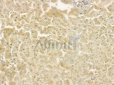 Rictor Antibody - DF7530 at 1/100 staining human normal liver tissue by IHC-P.