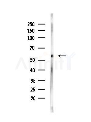 MDM4 Antibody - Western blot analysis of lysates from Hela cells(heat-shock,45min treatment), using MDM4 Antibody at 1/1000 dilution.