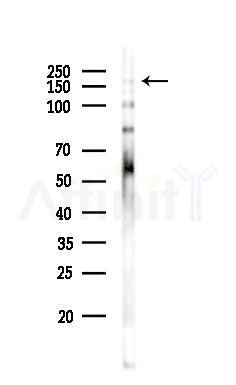 IRS2 Antibody - Western blot analysis of lysates from PC12 cells(LPS,4h treatment), using IRS2 Antibody at 1/1000 dilution.