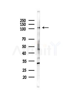 AGO1 Antibody - Western blot analysis of lysates from Hela cells(starvation,24h treatment), using AGO1 Antibody at 1/1000 dilution.