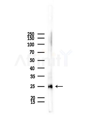 Casein Kinase 2 beta Antibody - Western blot analysis of lysates from Mouse lung, using Casein Kinase 2 beta Antibody at 1/1000 dilution.