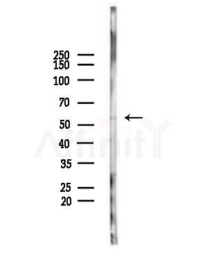 LEF1 Antibody - Western blot analysis of lysates from A375 cells(starvation,24h treatment), using LEF1 Antibody at 1/1000 dilution.