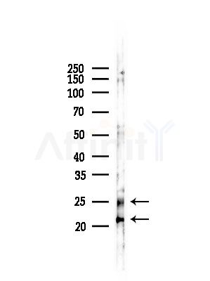 Rab10 Antibody - Western blot analysis of lysates from RAW264.
