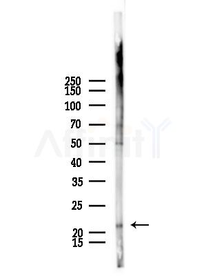 Rab10 Antibody - Western blot analysis of lysates from Mouse lung, using Rab10 Antibody at 1/1000 dilution.