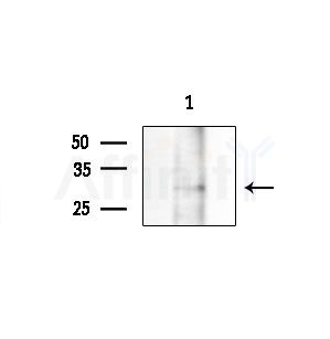 Calretinin Antibody - Western blot analysis of extracts from 293 cells(UV treatment), using Calretinin Antibody at 1/1000 dilution.