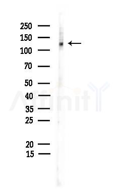 Phospho-ULK1 (Ser556) Antibody - Western blot analysis of lysates from Hela cells, using Phospho-ULK1 (Ser556) Antibody at 1/1000 dilution.