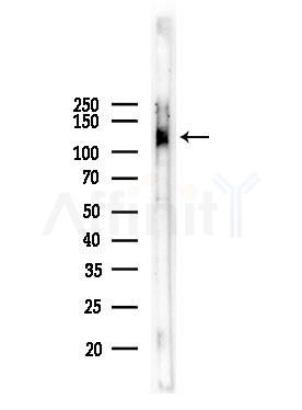 Phospho-ULK1 (Ser556) Antibody - Western blot analysis of lysates from Mouse testis, using Phospho-ULK1 (Ser556) Antibody at 1/1000 dilution.